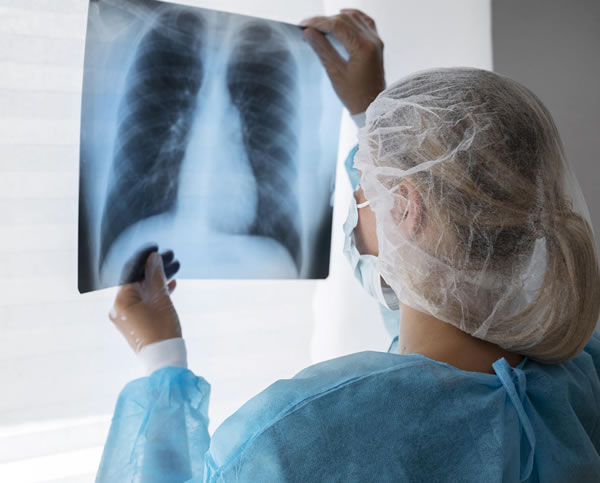 radiografia